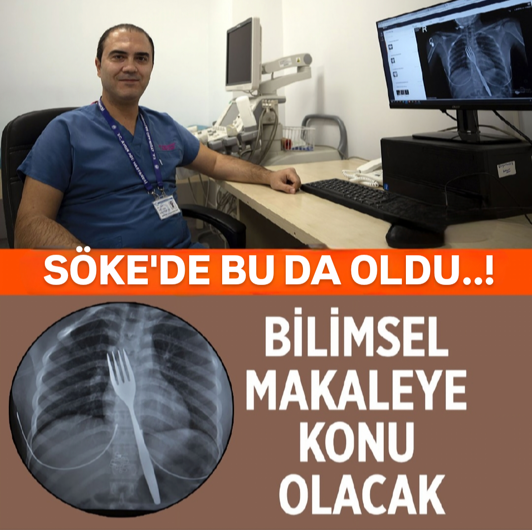 SÖKE'DE BU DA OLDU..! 